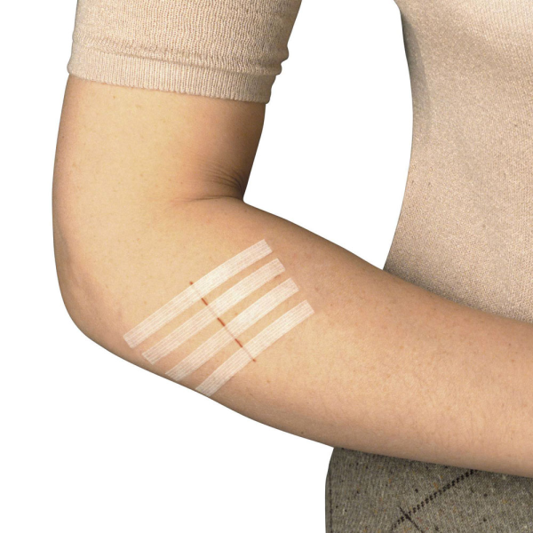 MASTER AID Sterigrap (6mm x 75mm) 6strips (Ταινία σύγκλησης Τραυμάτων)